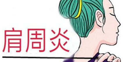 不良习惯为肩周炎埋下伏笔？玄鹿中频治疗仪